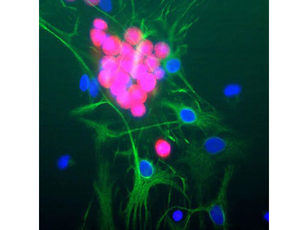 Immunofluorescence with Anti-FOX3