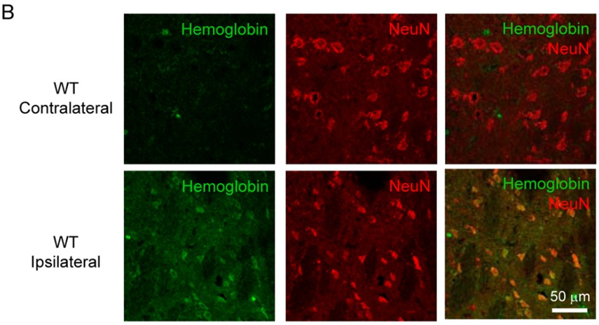 Immunofluorescence using FOX3