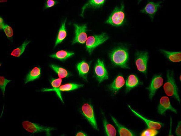 Immunostaining of Anti-Lamin A/C