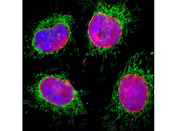 Immunostaining of Anti-Lamin A/C