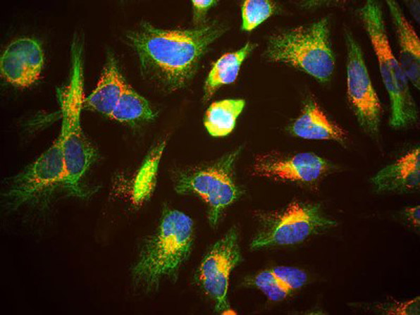 Immunolabeling of Anti-LAMP1