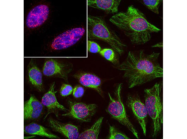 Immunoflourescence of anti-SAP49