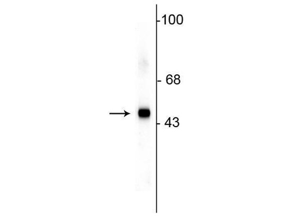 Western Blot of anti-SAP49