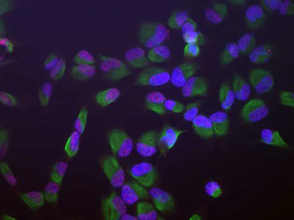 Immunoflourescence of anti-SAP49