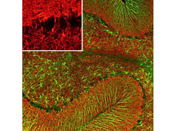 Immunofluorescence of Anti-Visinin-Like Protein 1 (VSNL1) antibody