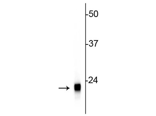 Western blot of Anti-Visinin-Like Protein 1 (VSNL1) antibody