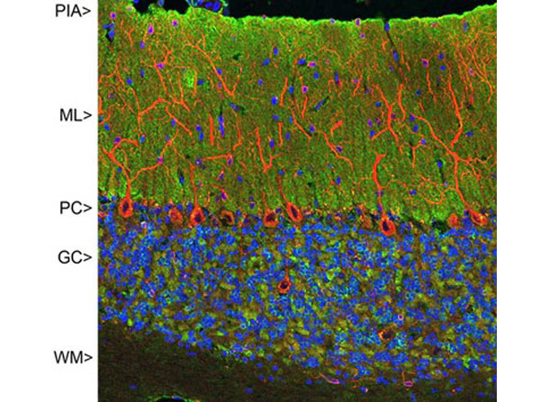 Immunofluorescence of Anti-Visinin-Like Protein 1 (VSNL1) antibody