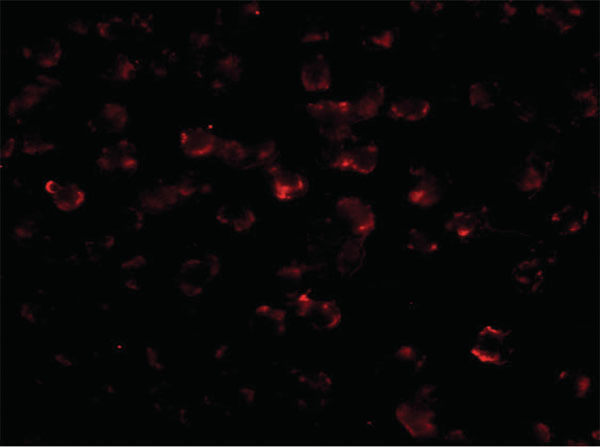 Immunofluorescence of Bim Antibody [1C2C8]