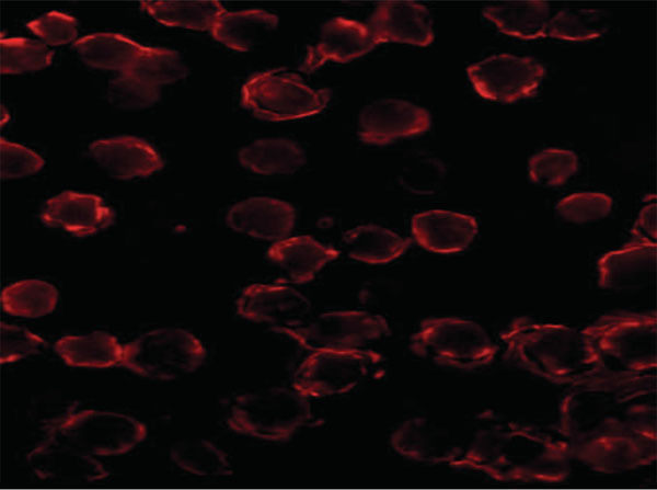 Immunofluorescence of Bim Antibody
