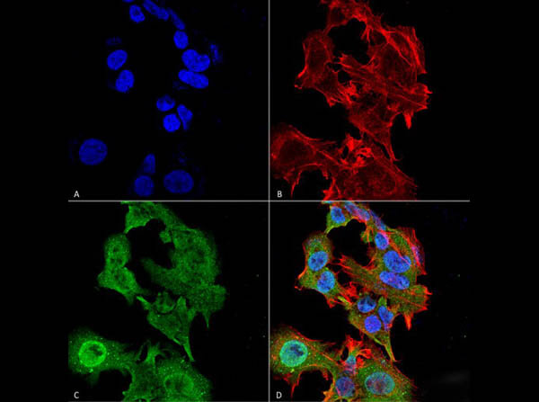 Immunofluorescence of Mouse Anti-GFAP Monoclonal Antibody