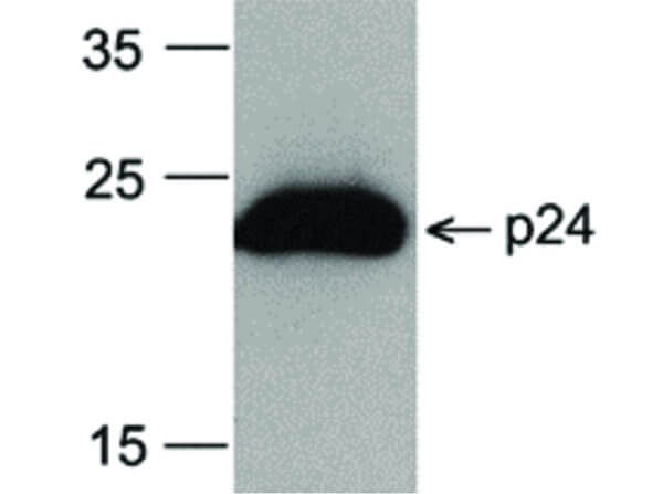 Western Blot of HIV-1 p24 Antibody