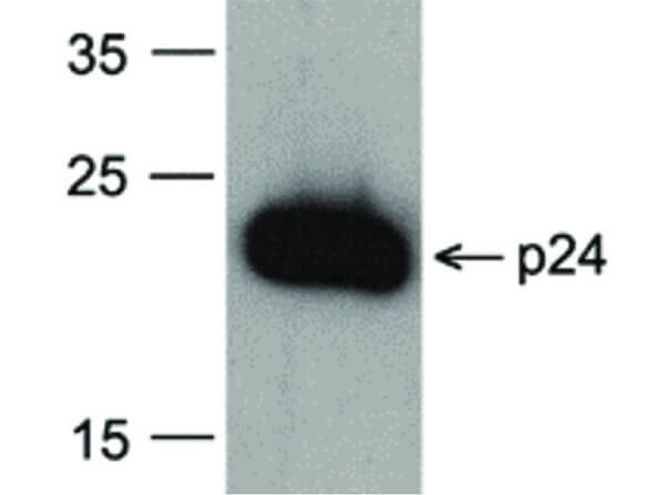 Western Blot of HIV-1 p24 Antibody