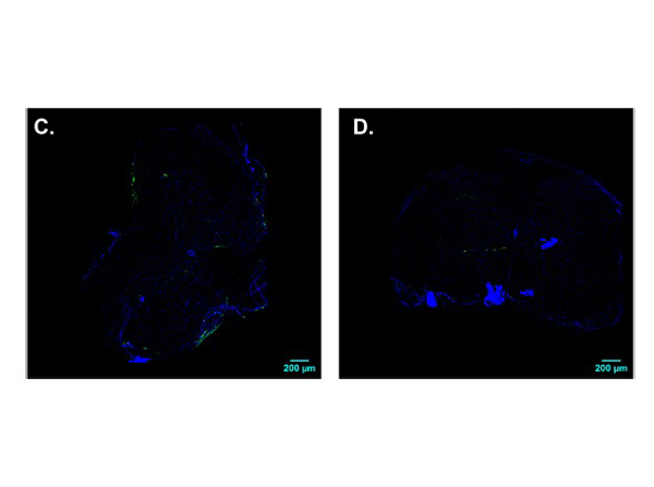 Immunofluorescence using Anti-FLAG®Dylight™ 488 Conjugated