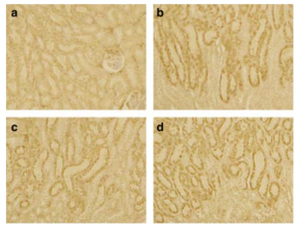 Immunohistochemistry using Catalase antibody