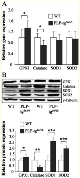 Western Blot using Catalase Antibody