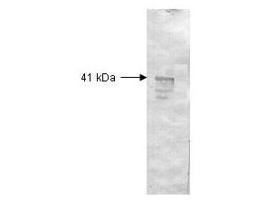 Anti-Dextranase Antibody - Western Blot