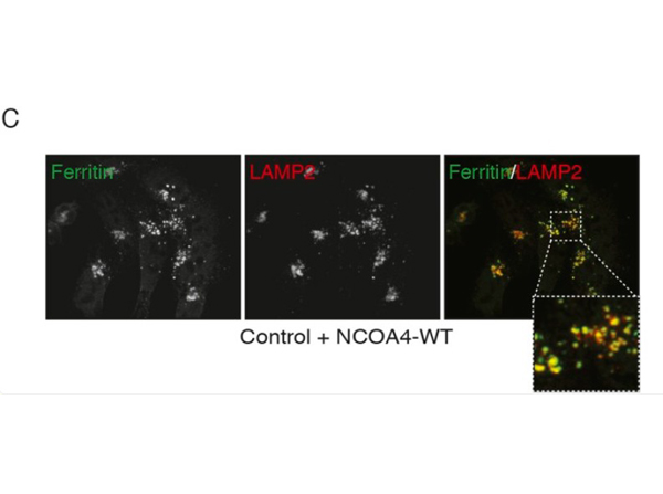 Immunofluorescence using Ferritin Antibody