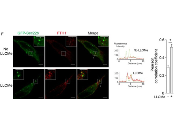 Immunofluorescence using Ferritin Antibody