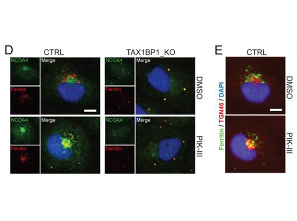 Immunofluorescence using Ferritin Antibody