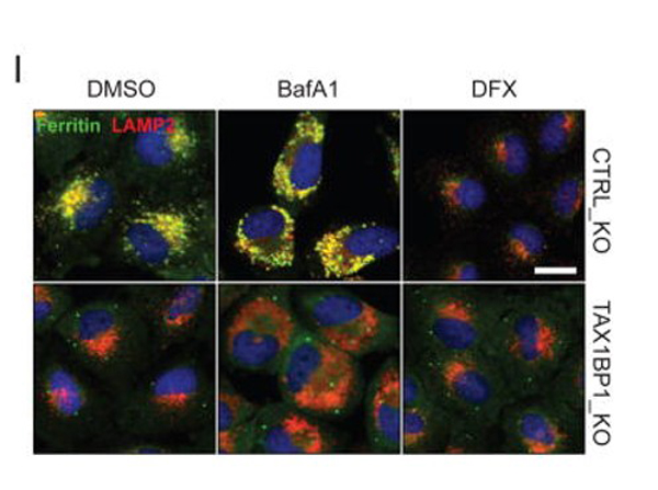 Immunofluorescence using Ferritin Antibody