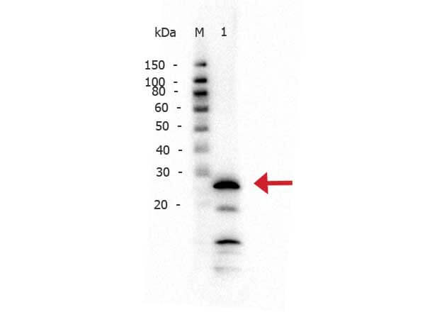 Rabbit anti-Trypsin WB