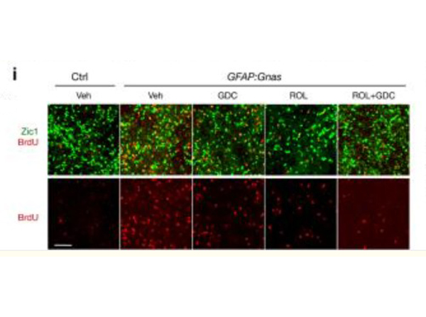 Immunofluorescence using Zic1