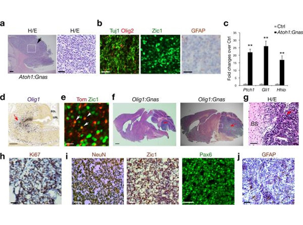 Immunofluorescence using Zic1