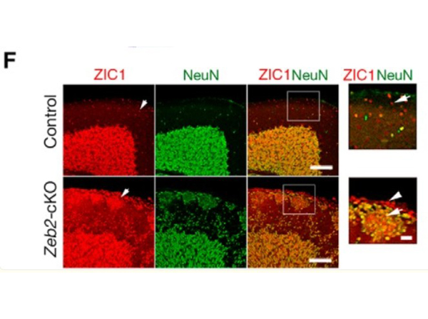 Immunofluorescence using Zic1