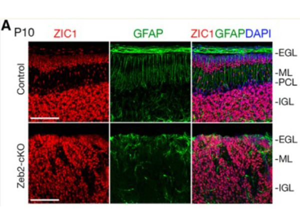 Immunofluorescence using Zic1
