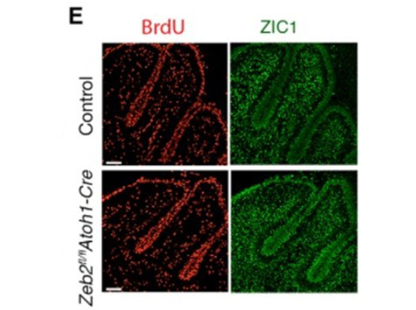 Immunofluorescence using Zic1