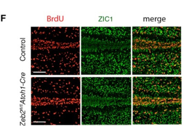 Immunofluorescence using Zic1