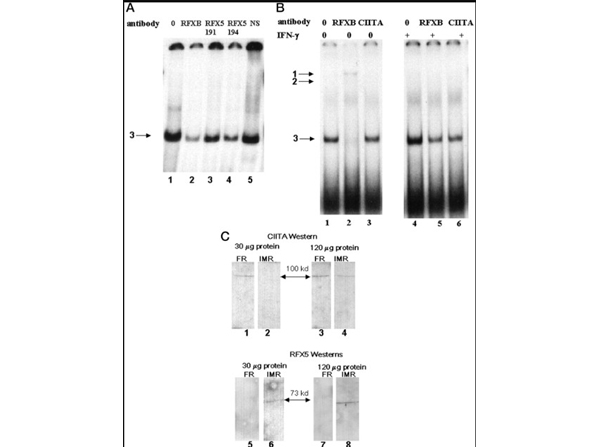 Western Blot of RXF5