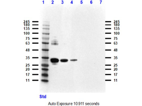 Western Blot using Rabbit Anti-HER3 Antibody