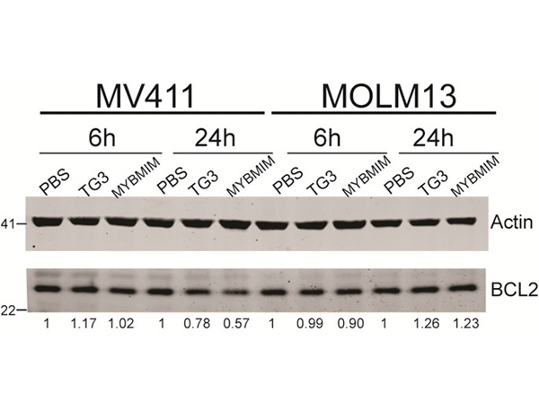 Western Blot using Bcl2