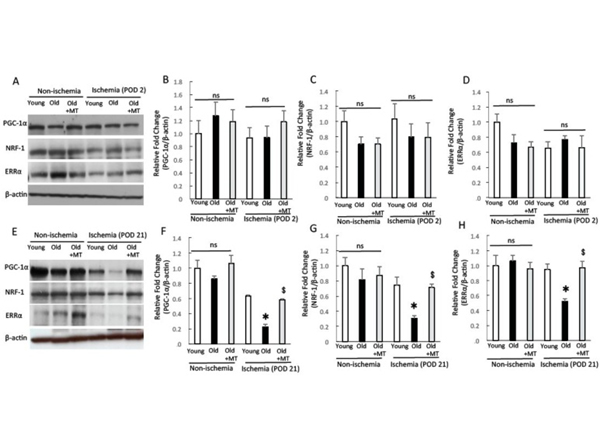 Western Blot using NFR1