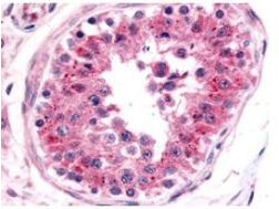 Anti-NRF1 Antibody - Immunohistochemistry