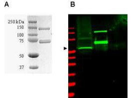 Anti-SUMO Activating Enzyme (SAE1) Antibody - SDS-PAGE/Western Blot