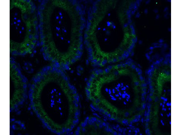 Immunofluorescence of ADAM10