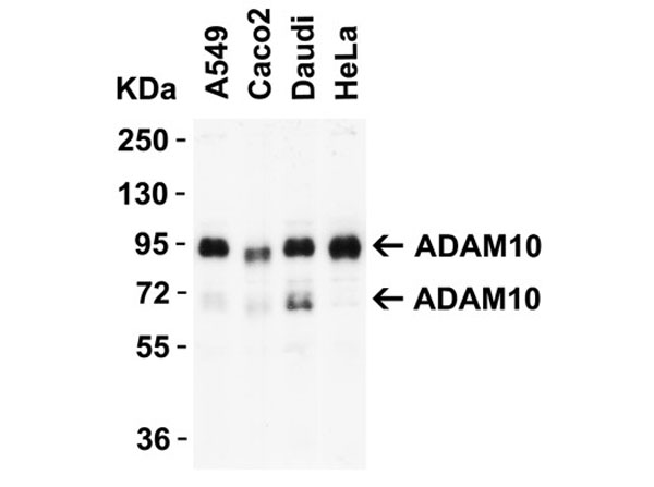 Western Blot of ADAM10