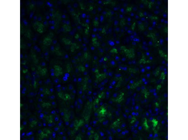 Immunofluorescence of ADAM10