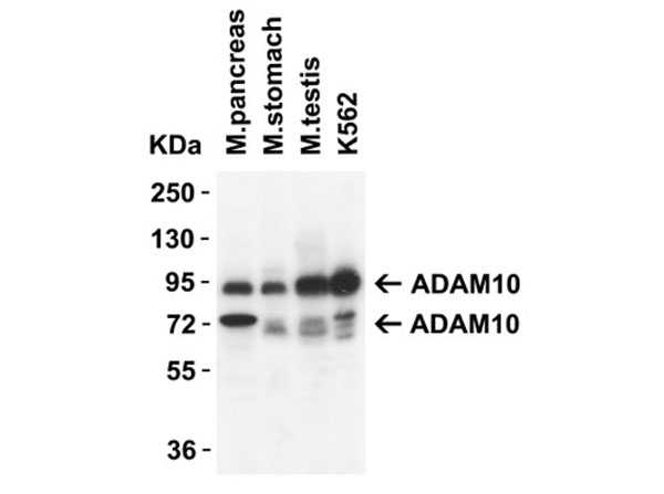 Western Blot of ADAM10