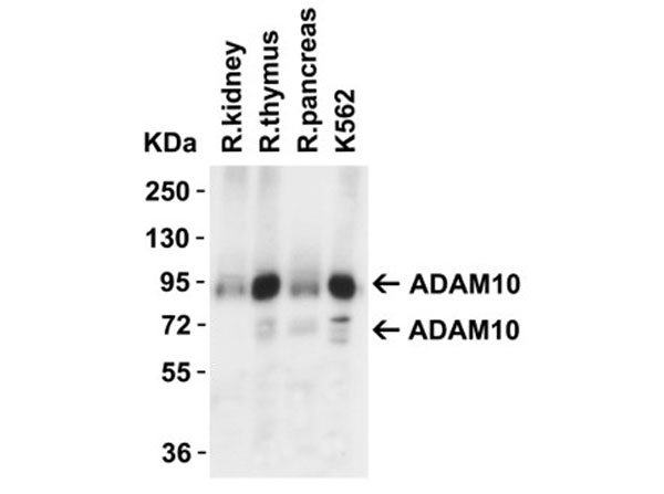Western Blot of ADAM10