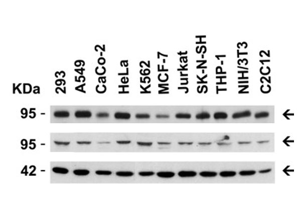 Western Blot of ADAM10