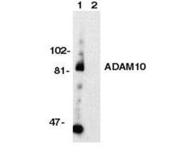 Anti-ADAM10 Antibody - Western Blot