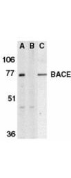 Anti-Beta-site APP-Cleaving Enzyme (BACE/Asp2) Antibody - Western Blot