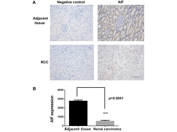 Immunohistochemistry using AIF