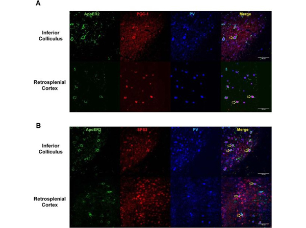 Immunofluorescence using SPS2