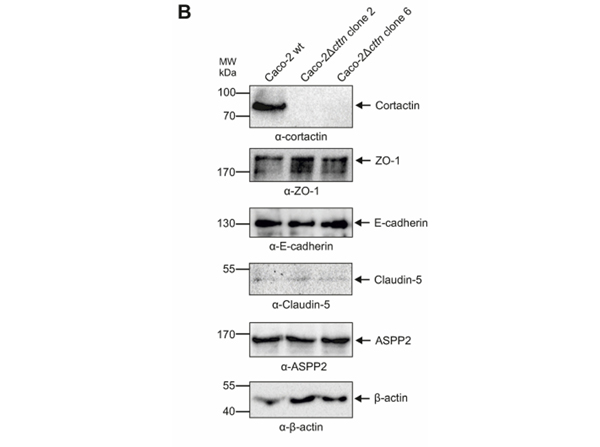 Western Blot using ASPP2