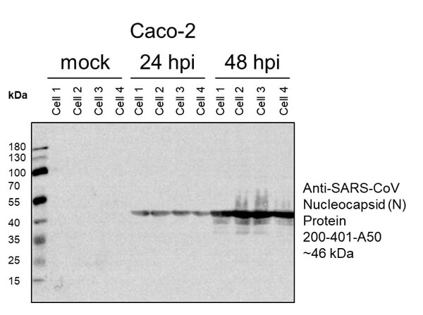 Western Blot of Rabbit Anti-SARS-CoV (N) Antibody
