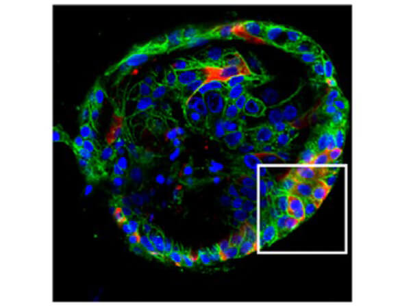Immunofluorescence of Rabbit Anti-SARS-CoV Nucleocapsid (N) Antibody